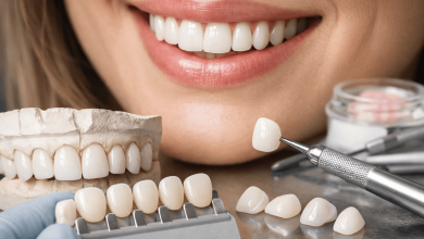 Керамические виниры: что влияет на стоимость процедуры в Украине