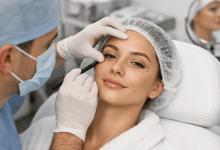 Блефаропластика: що важливо знати перед операцією на повіках