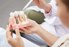 Имплантация зубов в Харькове: полный гид от А до Я для тех, кто хочет улыбаться без стеснения