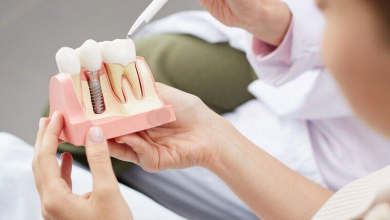 Имплантация зубов в Харькове: полный гид от А до Я для тех, кто хочет улыбаться без стеснения