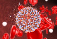 Неходжкинская лимфома: ответы на шесть самых важных вопросов