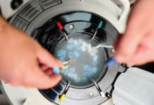 Заморозити яйцеклітини у Києві в «Мати та дитина»: переваги сучасних технологій